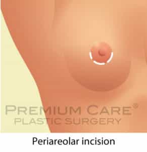 Breast Augmentation in Colombia Premium Care Plastic Surgery