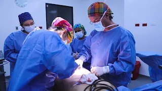 buttock augmentation in colombia