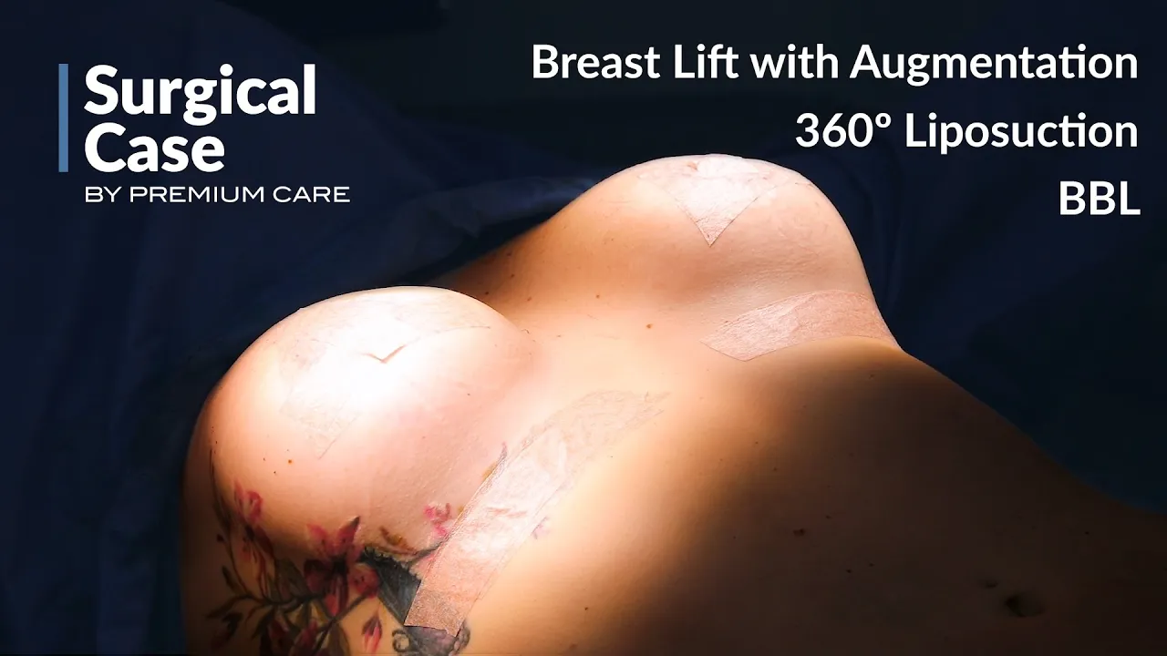 breast lift with augmentation colombia